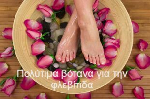 Πολύτιμα-βότανα-για-την-φλεβίτιδα