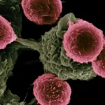 Τα τελευταία χρόνια, η επιστημονική έρευνα στρέφεται όλο και πιο συστηματικά στη μελέτη φυσικών σκευασμάτων για πιθανές αντικαρκινικές ιδιότητες. Αν και κανένα βότανο δεν αντικαθιστά την ιατρική θεραπεία, αρκετά φυτά φαίνεται να έχουν ενδιαφέρουσες βιοδραστικές ουσίες που χρήζουν περαιτέρω μελέτης.