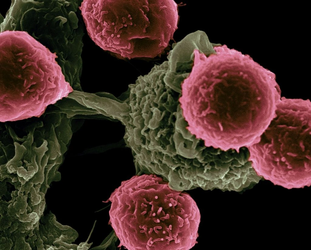 Τα τελευταία χρόνια, η επιστημονική έρευνα στρέφεται όλο και πιο συστηματικά στη μελέτη φυσικών σκευασμάτων για πιθανές αντικαρκινικές ιδιότητες. Αν και κανένα βότανο δεν αντικαθιστά την ιατρική θεραπεία, αρκετά φυτά φαίνεται να έχουν ενδιαφέρουσες βιοδραστικές ουσίες που χρήζουν περαιτέρω μελέτης.